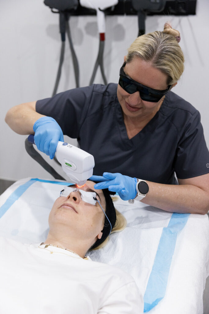 Contact us to learn more about IPL treatment Before & After