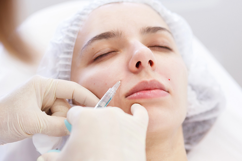 What Causes Smile Lines | How To Smooth Nasolabial Folds | Non-Surgical Skin Smoothing & Wrinkle Treatment | Queensland Skin & Laser