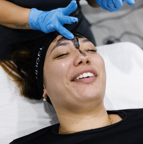 What are enlarged pores? How to treat enlarged pores