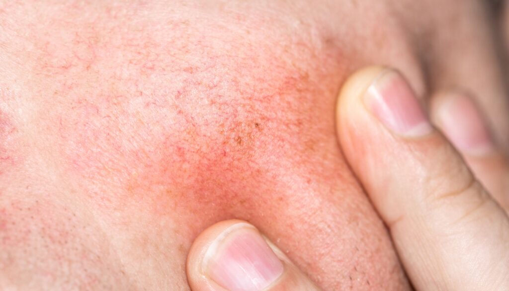 Skin concerns & conditions we can help with