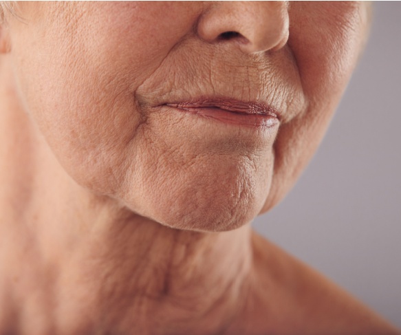 Sagging skin as we age is natural. Treatments to target sagging skin | Brisbane