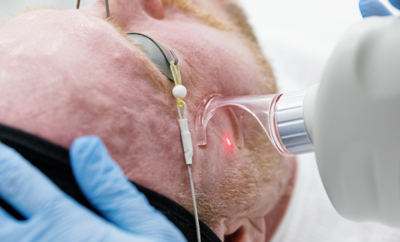 Learn more about CO2 Laser - what's the difference between ablative and fractional CO2 Laser?