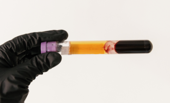 What is PRP and what are the benefits of PRP?