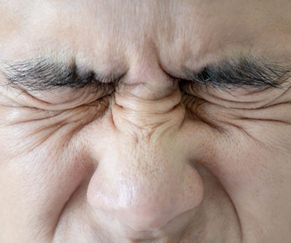 What are the wrinkles around the nose called? About bunny lines and what causes them