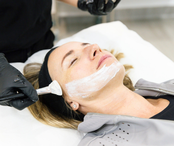 Chemical peel to exfoliate the skin and skin rejuvenation and clarity
