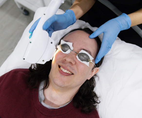 IPL Treatment Male 2 583x487
