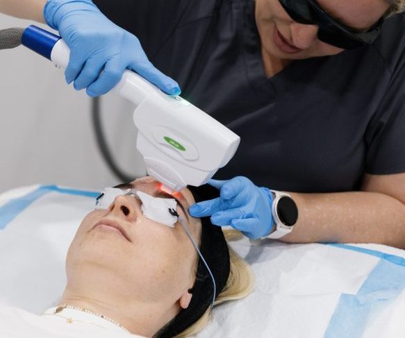 Registered dermal nurse performing IPL treatment Brisbane. Target pigmentation and sun damage with IPL treatment