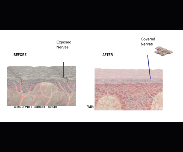 Preparing your skin before PDT can help support treatment effectiveness, treatment tolerance and overall skin health.