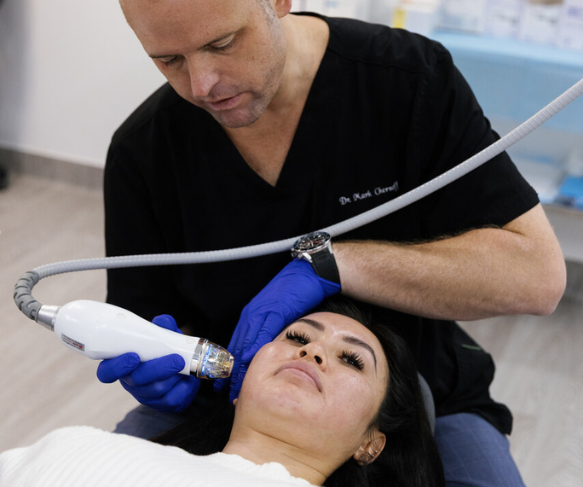 Stretch mark treatment with RF microneedling - combining microneedling w radio frequency energy to target appearance and texture of stretch marks