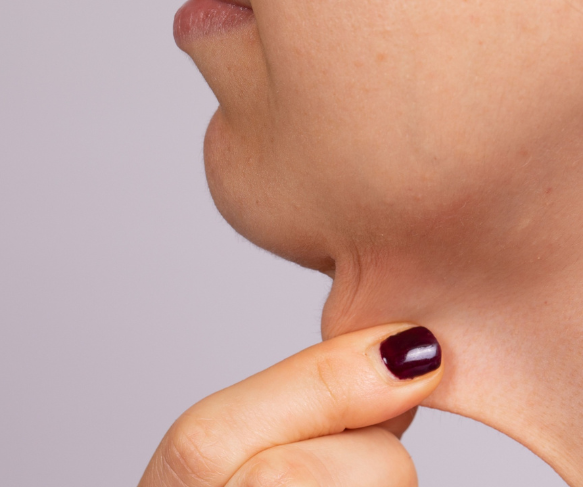 Loose skin and skin changes during weight loss