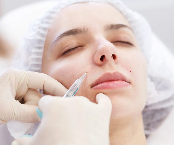 What Causes Smile Lines | How To Smooth Nasolabial Folds | Non-Surgical Skin Smoothing & Wrinkle Treatment | Queensland Skin and Laser