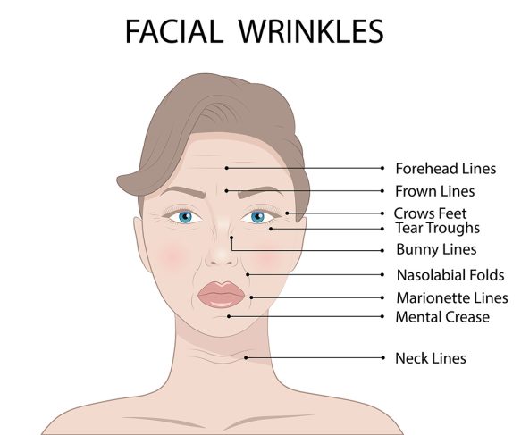 How To Soften Wrinkles | Causes Of Fine Lines | Skin Smoothing Cosmetic Medical Treatments | Dermal Clinic Brisbane | Queensland Skin and Laser